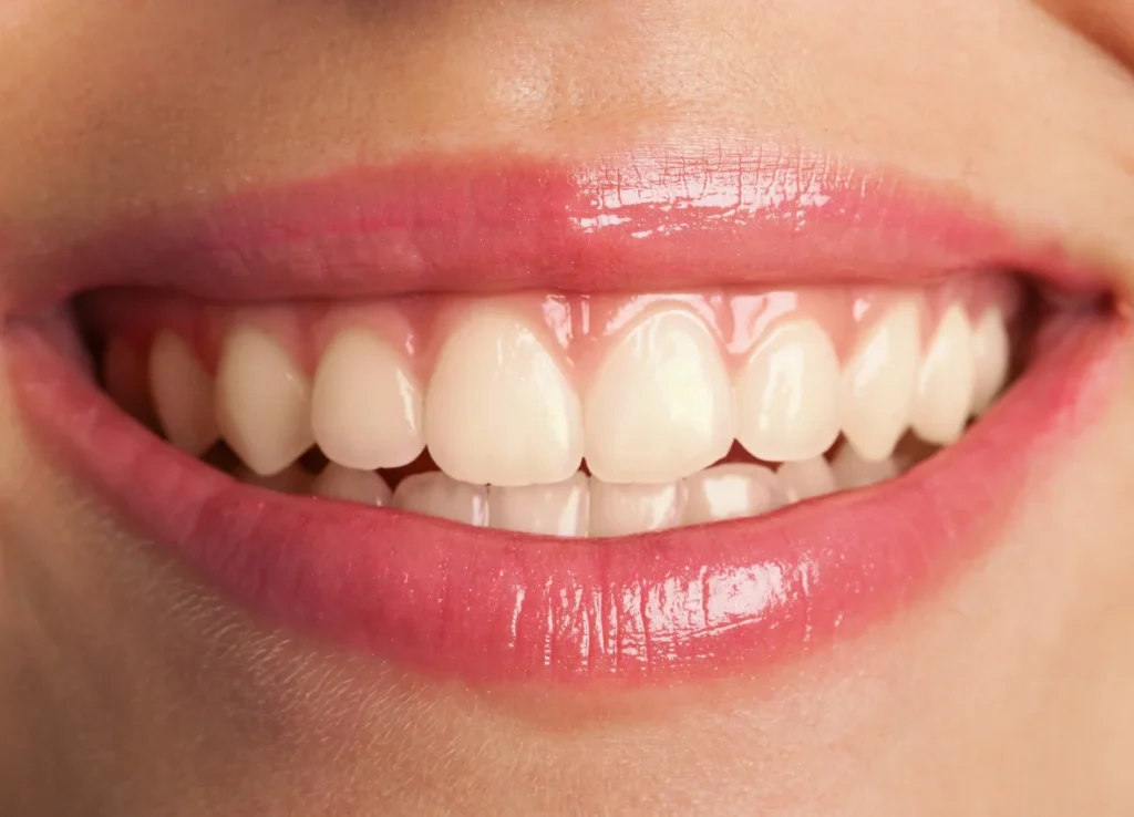 %clear braces%