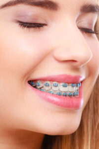%clear braces%