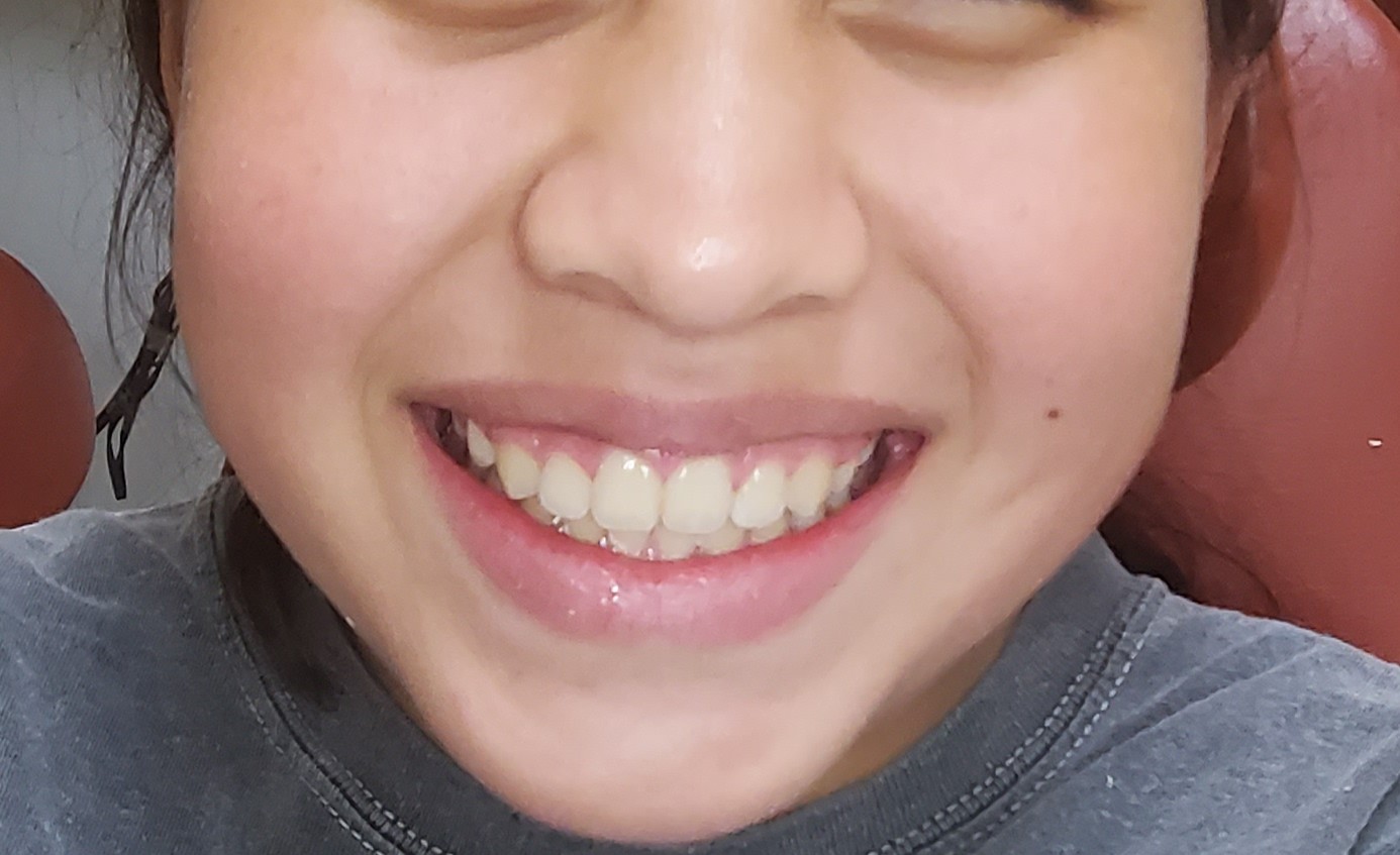After