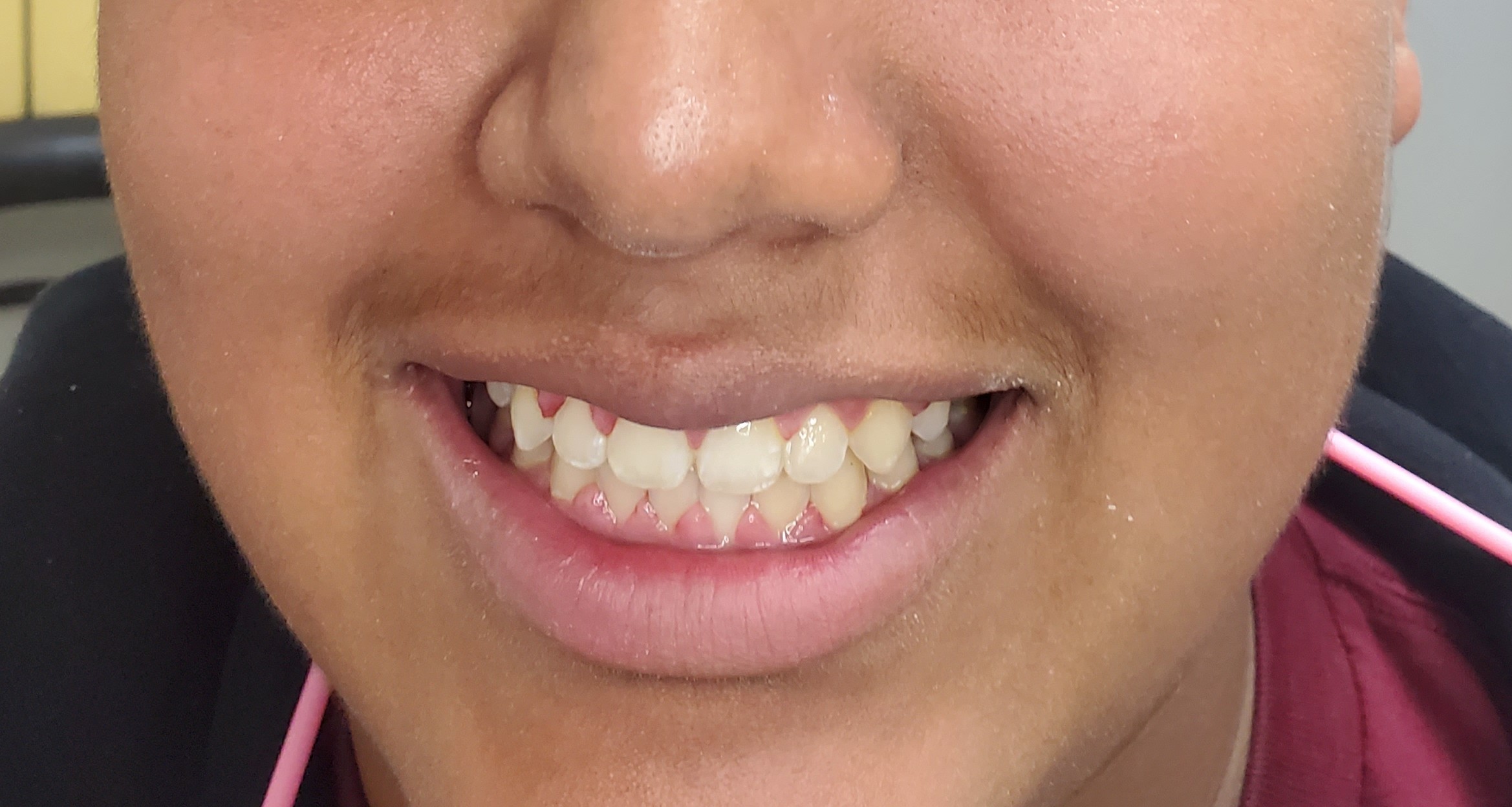 After