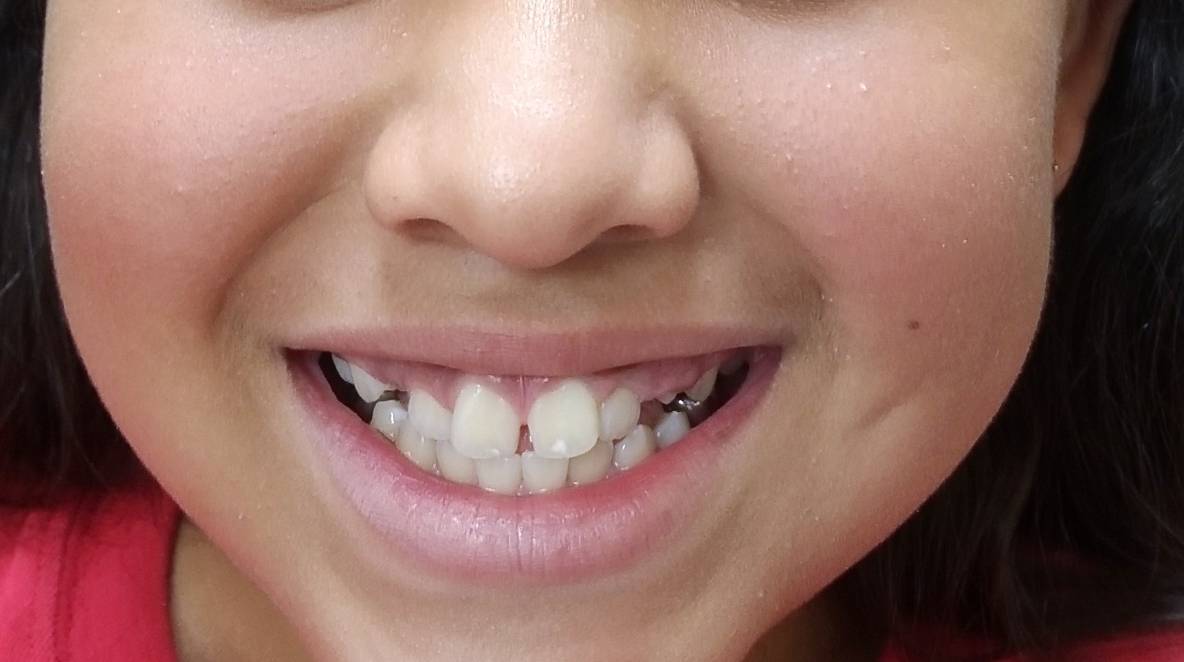 Before