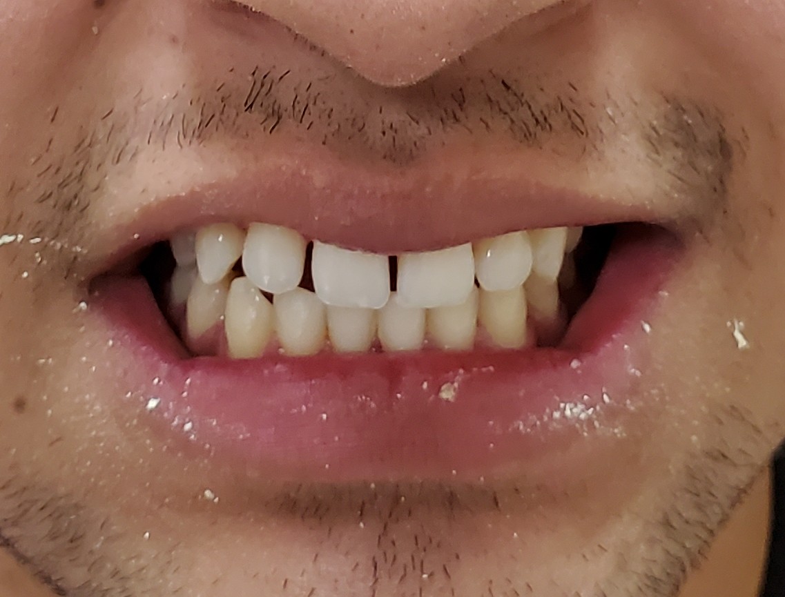 Before